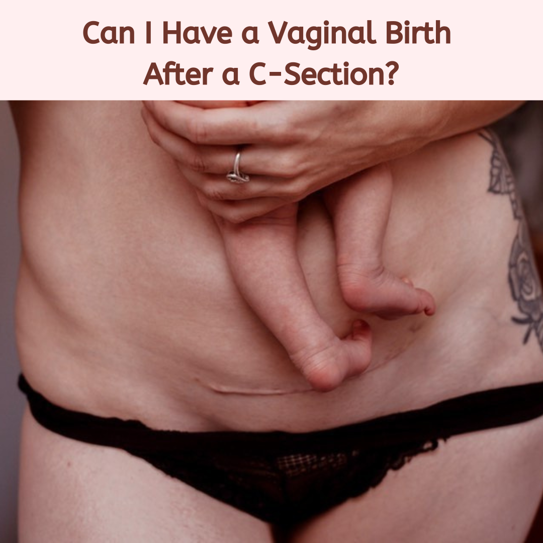 Can I Have a Vaginal Birth After a C-Section?